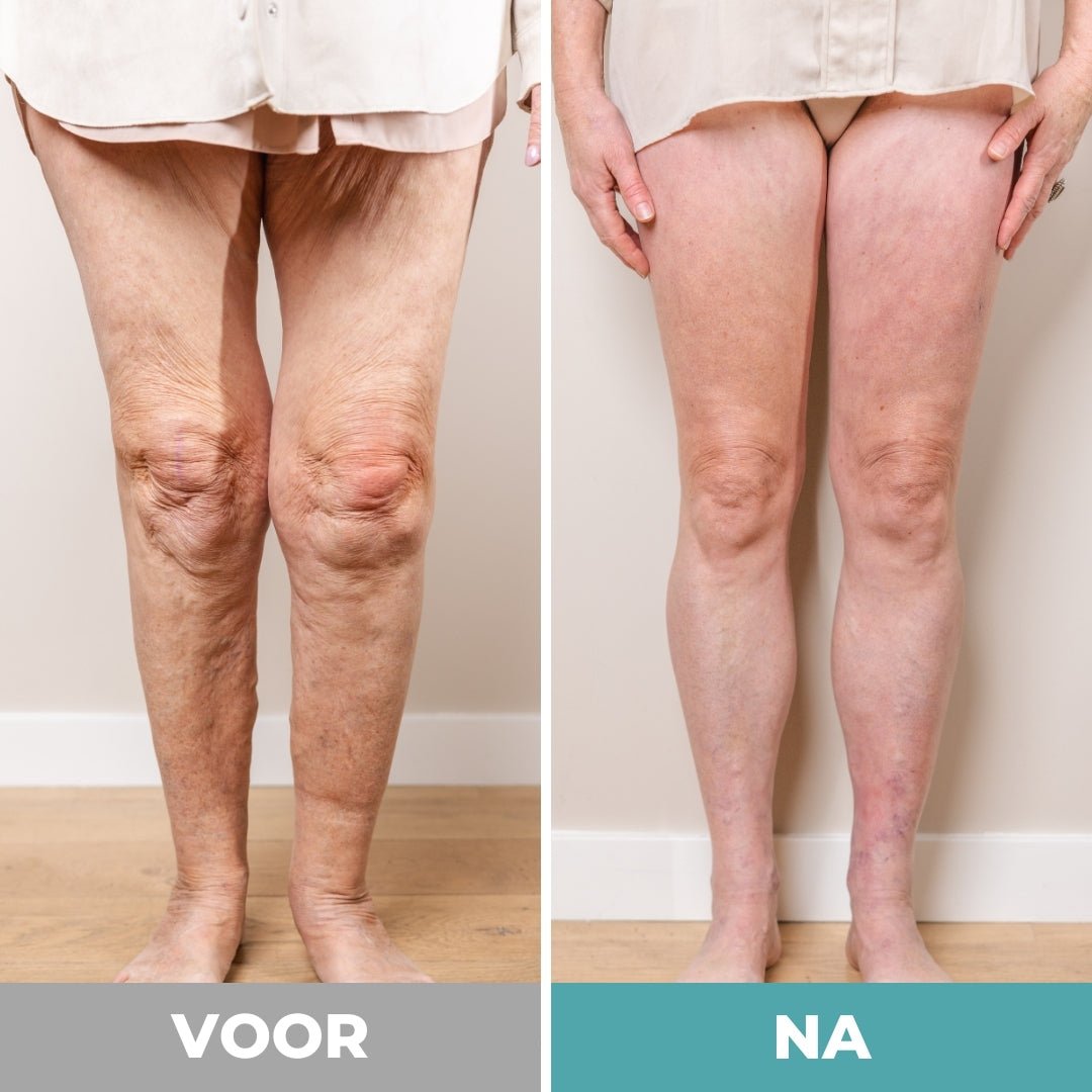 Voetmassager